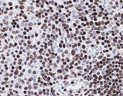 Immunohistochemistry-Paraffin: Histone H4 [ac Lys12] Antibody [NB21-2064] - Analysis of FFPE human tonsil using Histone H4 [ac Lys12] antibody at 1:500 on a Bond Rx autostainer (Leica Biosystems). The assay involved 20 minutes of heat induced antigen retrieval (HIER) using 10mM sodium citrate buffer (pH 6.0) and endogenous peroxidase quenching with peroxide block. The sections were incubated with primary antibody for 30 minutes and Bond Polymer Refine Detection (Leica Biosystems) with DAB was used for signal development followed by counterstaining with hematoxylin. Whole slide scanning and capturing of representative images was performed using Aperio AT2 (Leica Biosystems). Nuclear staining was observed. Staining was performed by Histowiz.